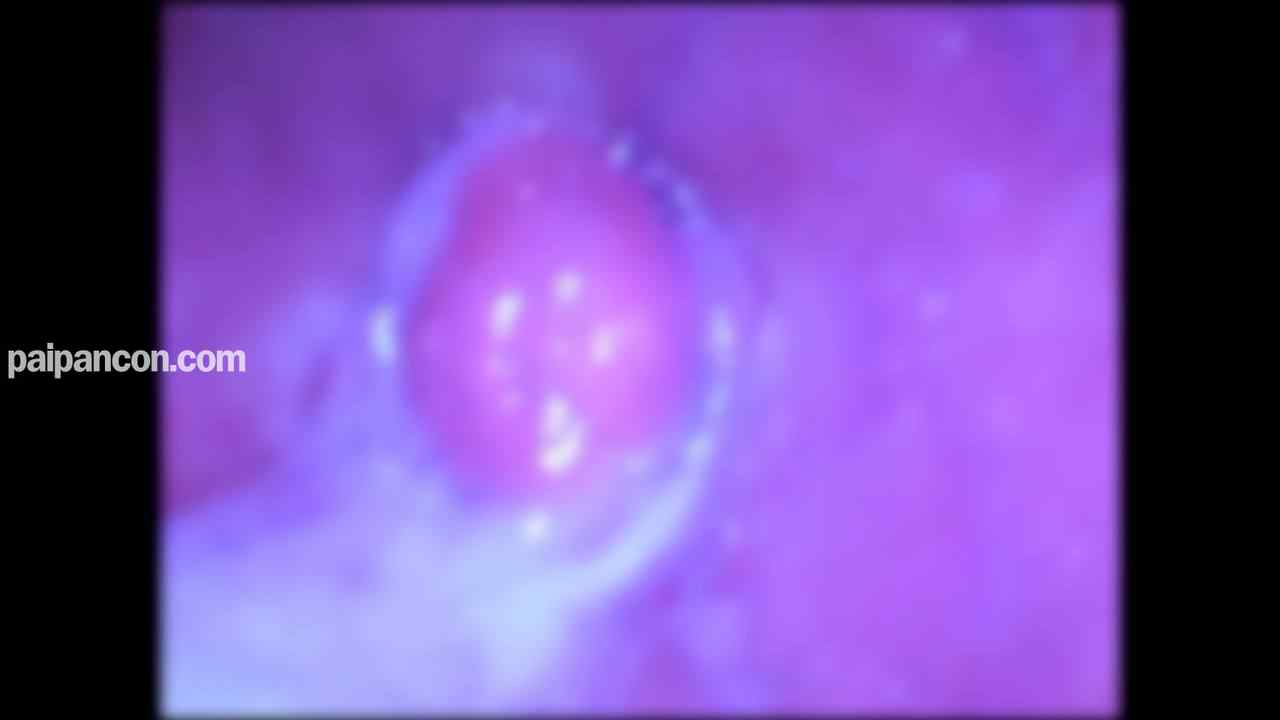 FC2-PPV-4653783 - ★特典で無修正と膣内カメラ ♀143 めがねっこ あんなちゃんの透き通る白いBODYにたっぷり中だし♡ めがねっこもかわいくていいもんですなあ thumbnail_9.jpg