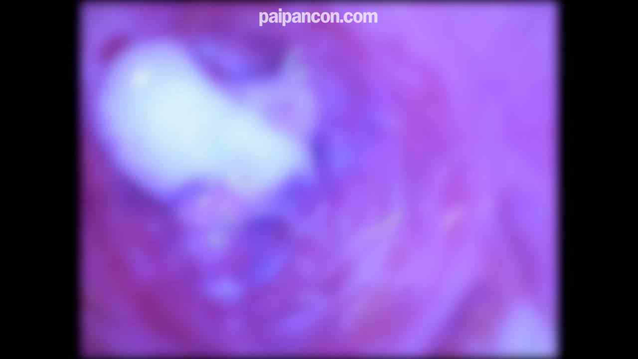 FC2-PPV-4658241 - ★特典で無修正と膣内カメラ ♀145 ウブでピュアなさくらちゃん。こんなおなごでもでAVに出なきゃいけないこんな世の中、、、でもたっぷり中だしです♡ thumbnail_9.jpg